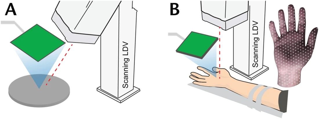 Time-resolved optical vibrometry characterizations were obtained during focused ultrasound stimulation of a tissue phantom and human hands