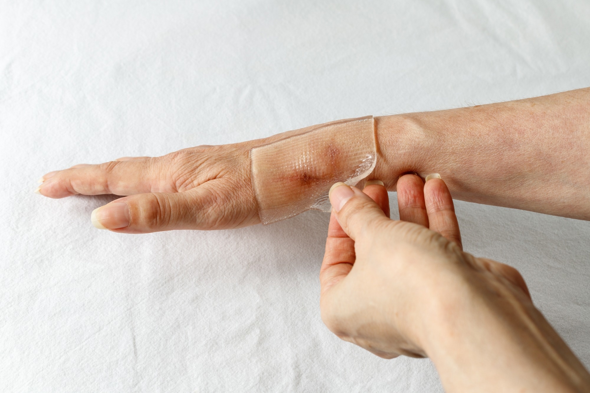 A close-up image of a hand with a transparent silicone gel sheet being applied to a healing wound on the wrist. The sheet conforms to the skin, covering the affected area to assist in wound care or scar management. The background is a plain white surface.