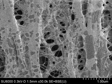 Separator imaged at 300 V showing residues after cycling