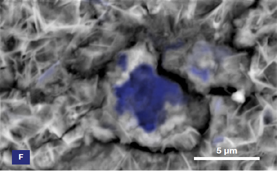 ChemiSEM images of the foreign particle. From top to bottom: backscattered electron image, calcium, fluorine, and silicon distribution. (Acc voltage 15 keV, beam current 0.85 nA, acquisition time 60 s).