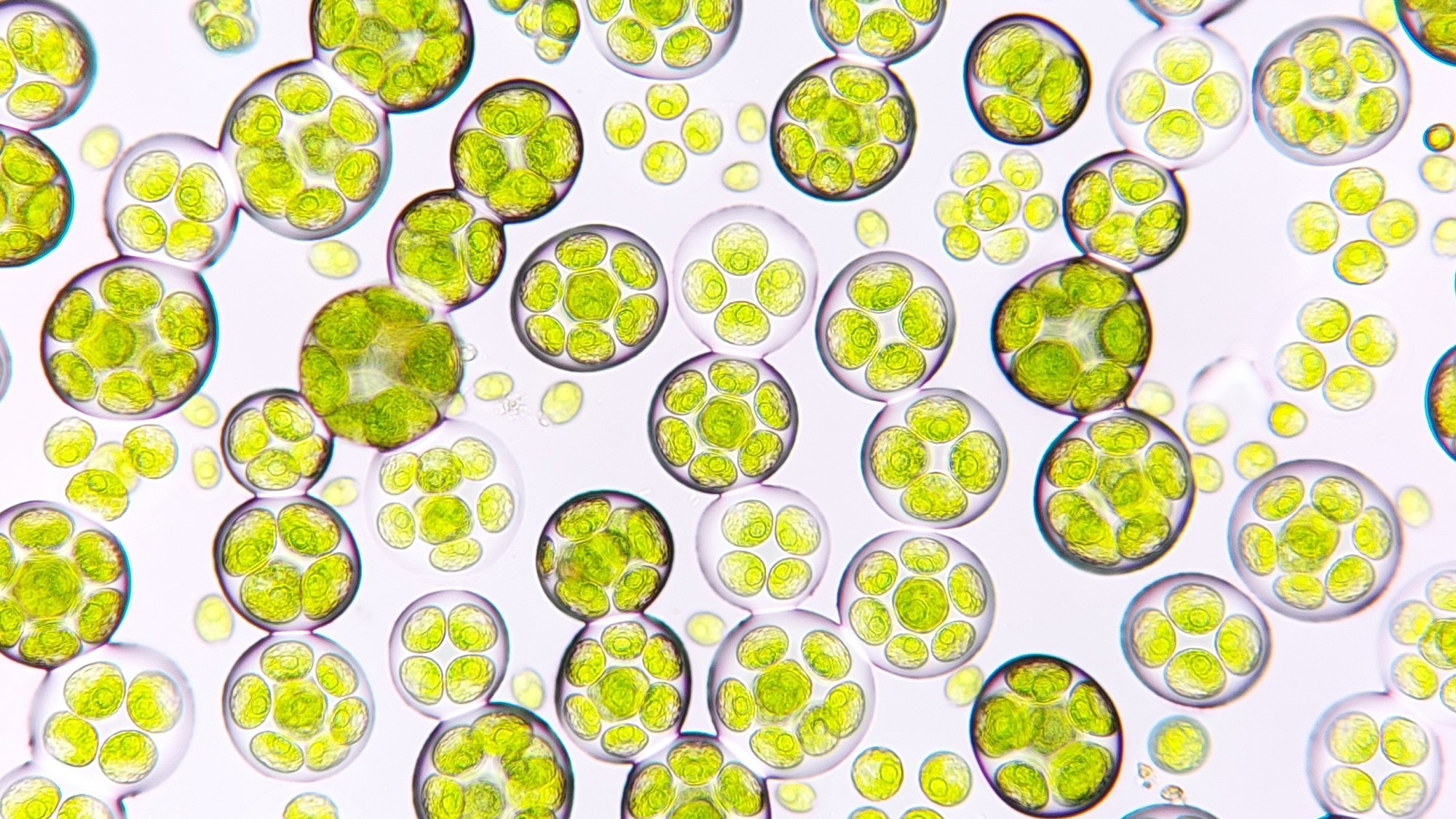 Freshwater microalgae blooming under microscope. The species is probably Chlamydocapsa sp. 800x magnification. Live cell. Selective focus