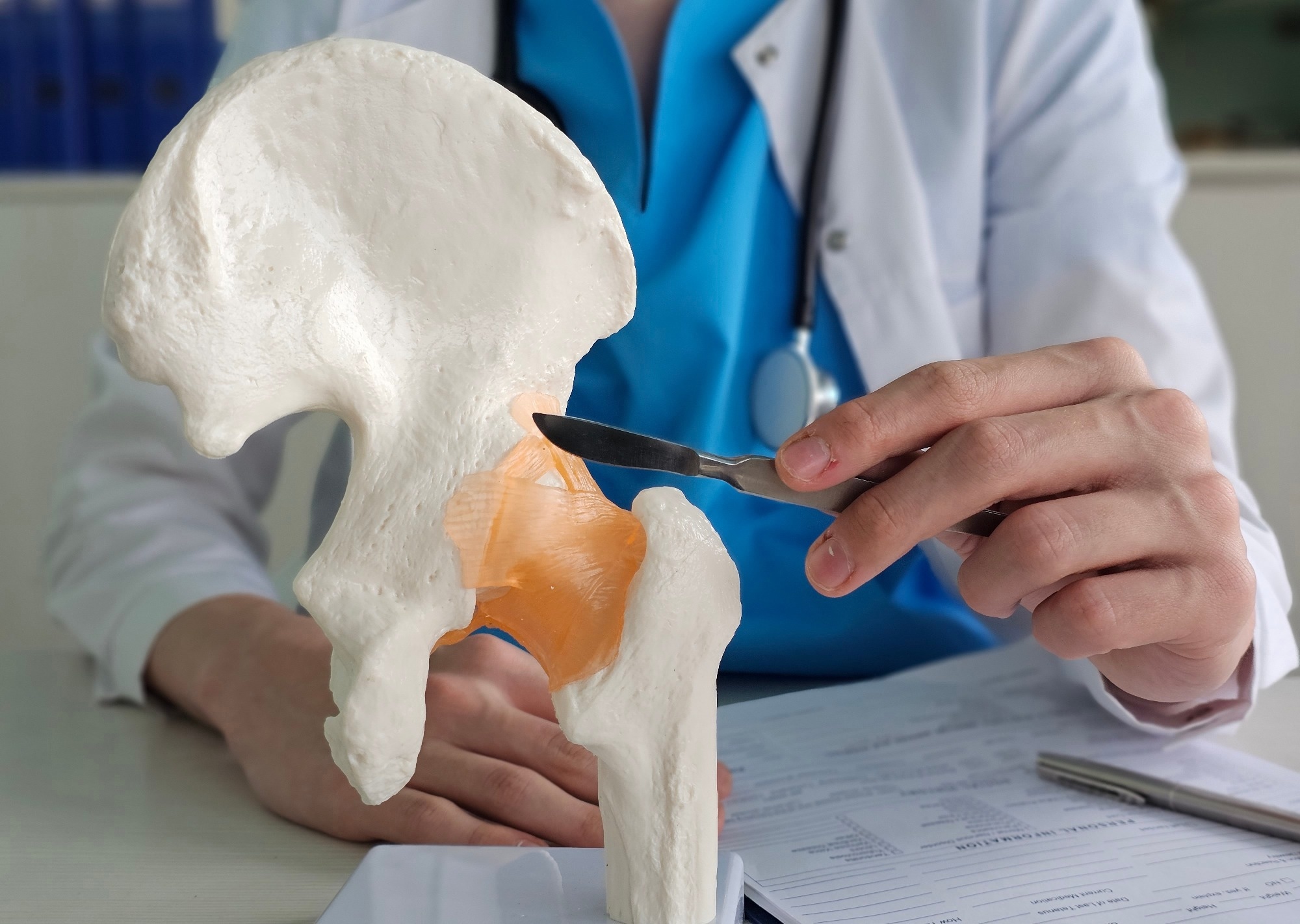 Hip replacement surgery. A doctor holds a scalpel. Hip arthroplasty concept