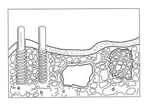 AZoM - Metals, Ceramics, Polymer and Composites : Biomaterials – Diagram showing the different Behaviour modes of the Different Types of Biomaterials