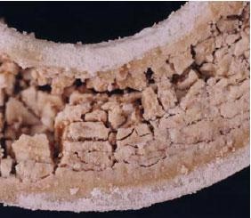 The bearing showed cracking and loss of material integrity, which was characteristic of severe chemical attack.