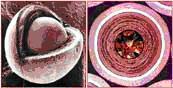 SEM photomicrographs showing the coating structure of a typical TRISO particle.1