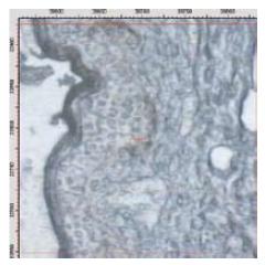 IR imaging of a sample of human skin tissue. Middle panel: transverse section (250 x 250 μm2; 15μm), measured using a Bruker HYPERION (8 cm-1 resolution, 15x, transmission). Upper panel: integrated signal intensity in the CH stretch vibration range (3000 – 2800 cm-1) = lipid distribution. Lower panel: integrated signal intensity in amide range (1720 – 1480 cm-1) = protein distribution.