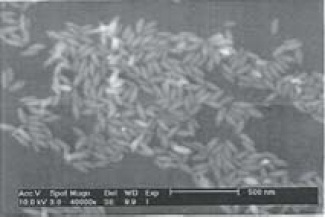 The SEM photomicrograph shown is a representative sample of hematite spindles.