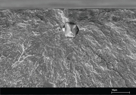 Scanning electron microscopic image of a 5µm oxide inclusion as a failure initiating site. The component failed due to a fatigue crack which was originated at the top of the unwanted feature in the microstructure within the (535A99) 100Cr6 matrix.