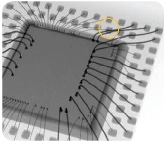 A 2D X-ray image of a wire-bonded package