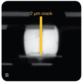 3D X-ray microscopic images of a package-on-package (PoP) assembly. (A) The 3D micrograph shows the microstructure of the stacked packages; (B) A 2Ijm crack was observed in a bump near the circuit board interface. Courtesy of ST-Ericsson Grenoble Failure Analysis Lab; (C) Multiple voids were found at the interface between the interposer and the top package.