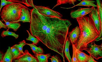 Two-Photon Non-Linear Microscopy