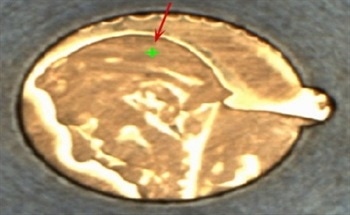 Analysis of Gold Alloys for Accurate Determination of Gold