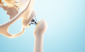 An Overview of Biomaterials: Advancements and Applications