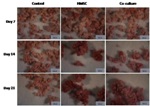 Applications of Nanostructured Hydroxyapatite for Osteogenesis and Angiogenesis