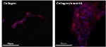 Improving Bone Regeneration Using Nanohydroxyapatite
