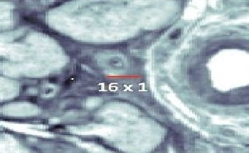The Benefits of Laser-Based Infrared (IR) Chemical Imaging Microscopy for High Resolution Spectral Imaging