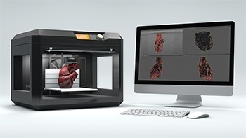 3D Printed Heart Models and Treatment Advancement