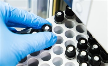 High-Performance Liquid Chromatography vs. Ultra-High Performance Liquid Chromatography