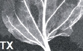 Using EDXRF for Elemental Micro-Analysis in Biological Applications