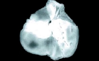XRF Microscopy and its Applications in Biology