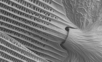 Differences Between an SEM-FIB, an SEM, an (S)TEM and an ESEM