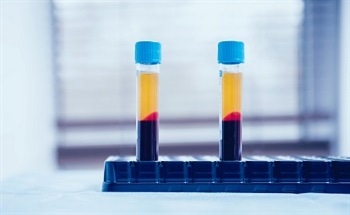 Applications of OES and Plasma Diagnostics