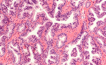 An Introduction to Label-Free Digital Pathology