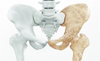 Increasing Demand of Technical Ceramics in the Medical Industry - What is Driving It?