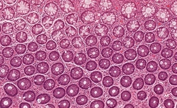 Biomaterials: Mechanical Testing for Medical Devices