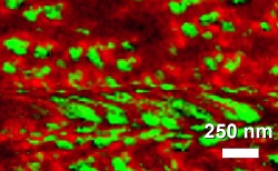 Why TERS is Beneficial for Nanotoxicological Studies