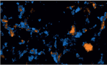 Using Raman Microscopy for Polymorphism Characterization