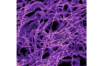 Creating and Manipulating Vortex-Antivortex Pairs in Ferroelectric Materials Using Piezoresponse Force Microscopy (PFM)