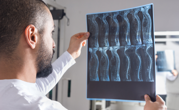 Restoring Motor Functions in Paralyzed Patients with 3D Printing Technology