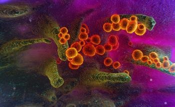 SEM Imaging and the Benefits of Using Low kV