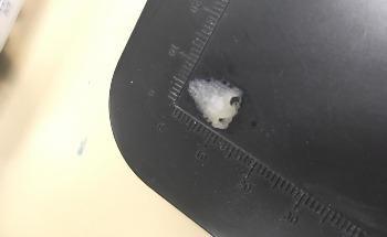 How a Multi-institutional Team is using 3D Printing to Aid Tissue Replacement