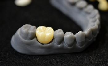 How 3D Printing Could Help to Regrow Teeth from the Root