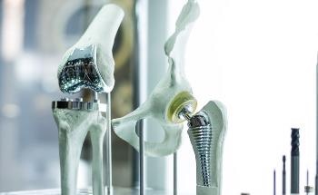 3D Printing Metallic Implants: Technologies Available and the Future of the Industry