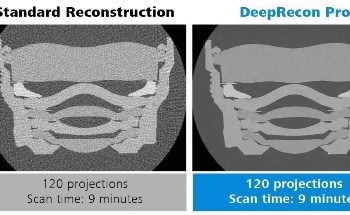 Improving X-Ray Image Reconstruction with the Advanced Reconstruction Toolkit