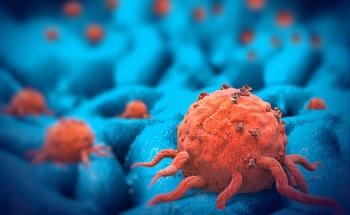 Immunotherapy Tracking Using Raman Spectroscopy