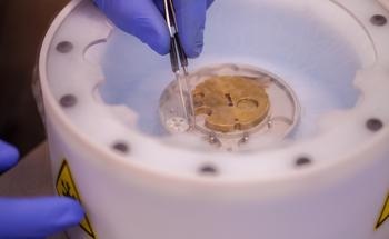What is Freeze-Fracture Electron Microscopy?
