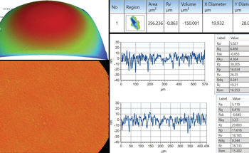 Using White Light Inferometry to Measure Orthopedic Implants