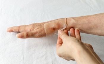 Advances in Bio-Inspired Adhesive Technologies