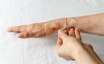 The Use of Silicone in Medicine