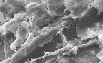 Advances in Counted EELS for High-Resolution Materials Analysis