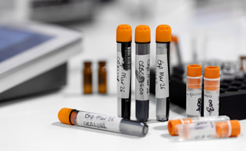 Why Modern Labs Still Struggle with Vial Labeling Accuracy