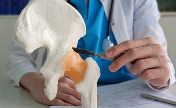 Beyond Metal: The Materials Reshaping Hip and Knee Implants