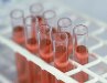 Gold - A Superior Component in Rapid Test Applications - World Gold Council