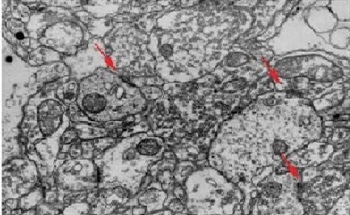 Extreme Field of View Images Provide A Complete Understanding of Structures from Macro to Nanoscales