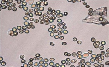 Using Ultraviolet Microscopy and Microspectroscopy to Analyze Red Blood Cells