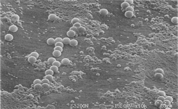Laser Diffraction Particle Size Analyzers Need PIDS to Measure Small Particles